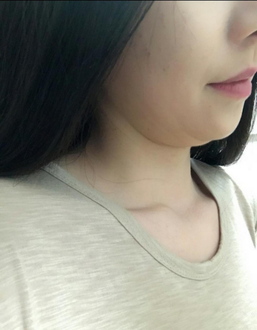 後