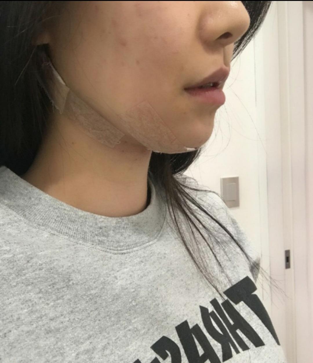 後