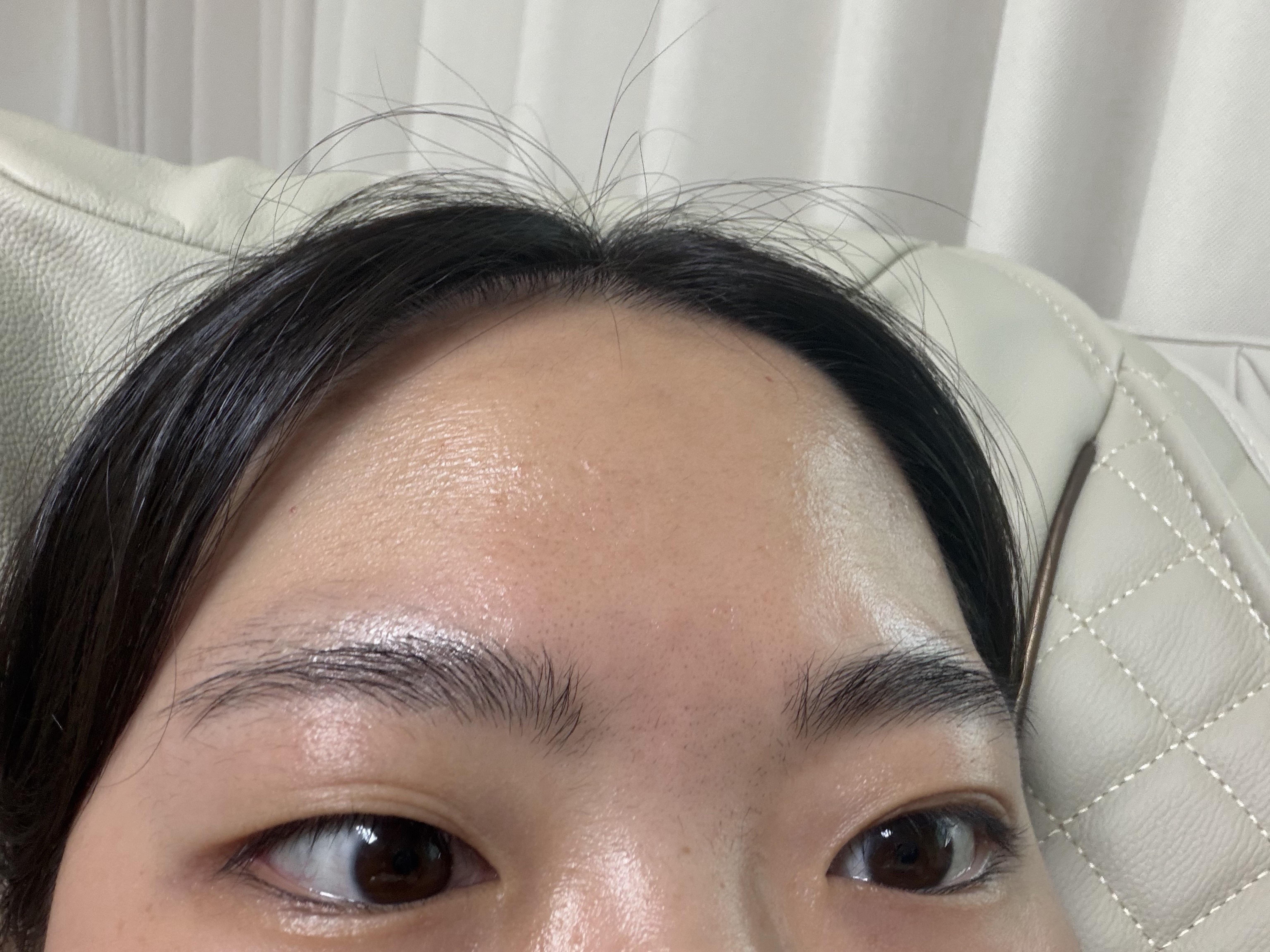 後