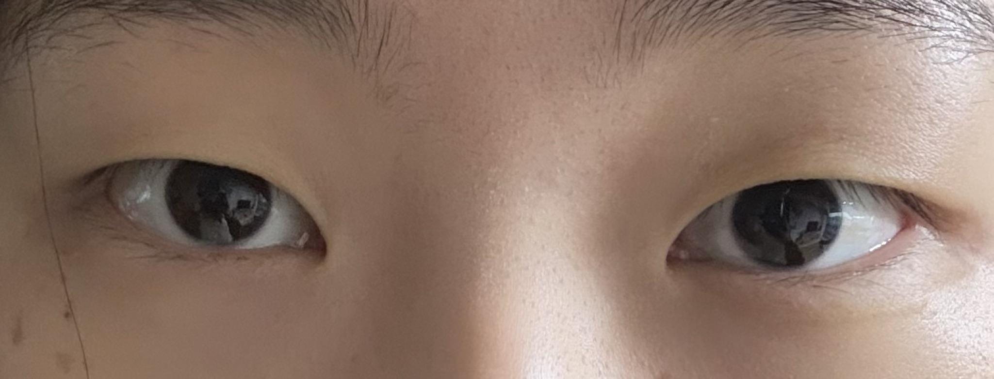 後