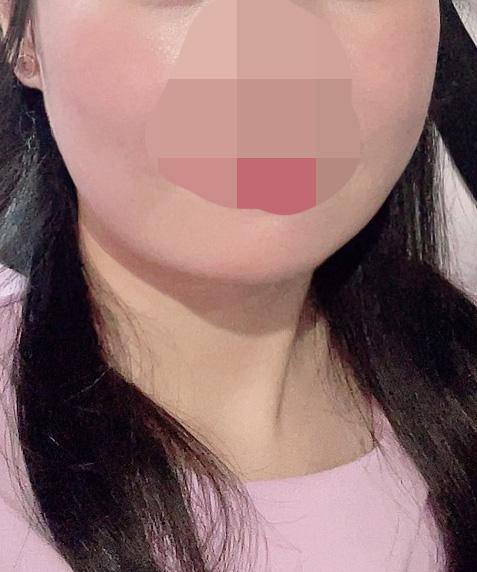 後
