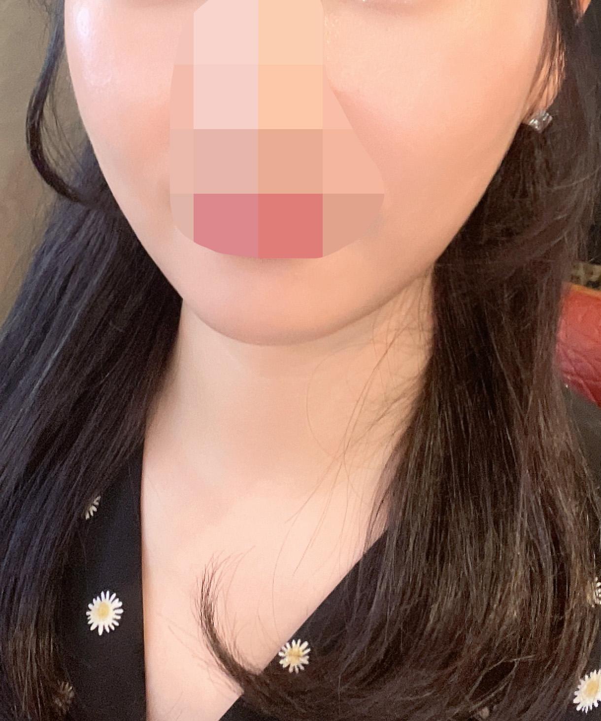 後
