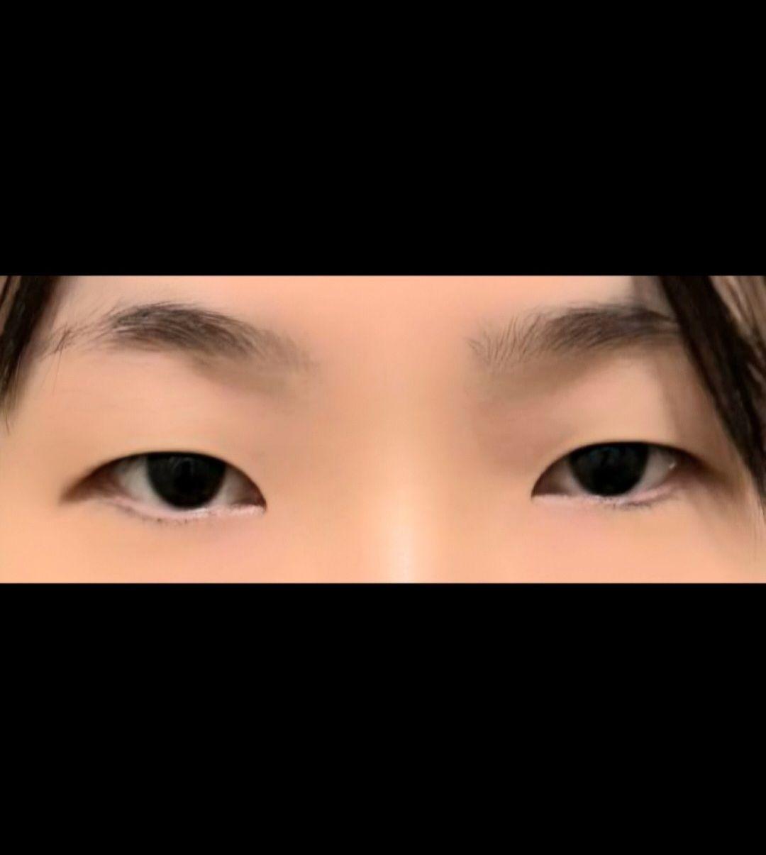 後