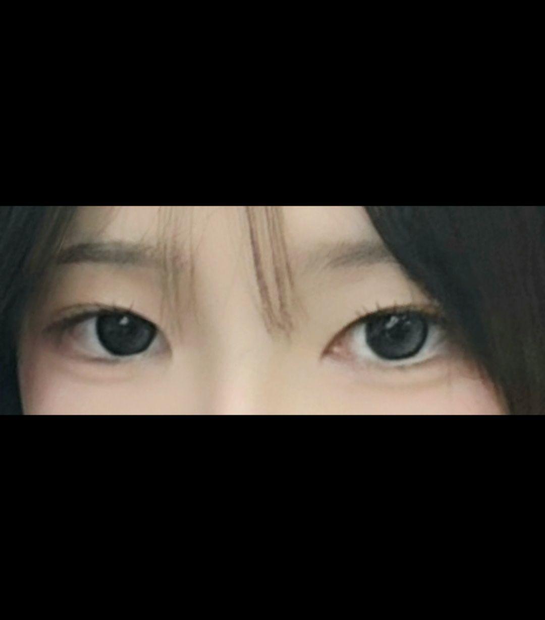 後