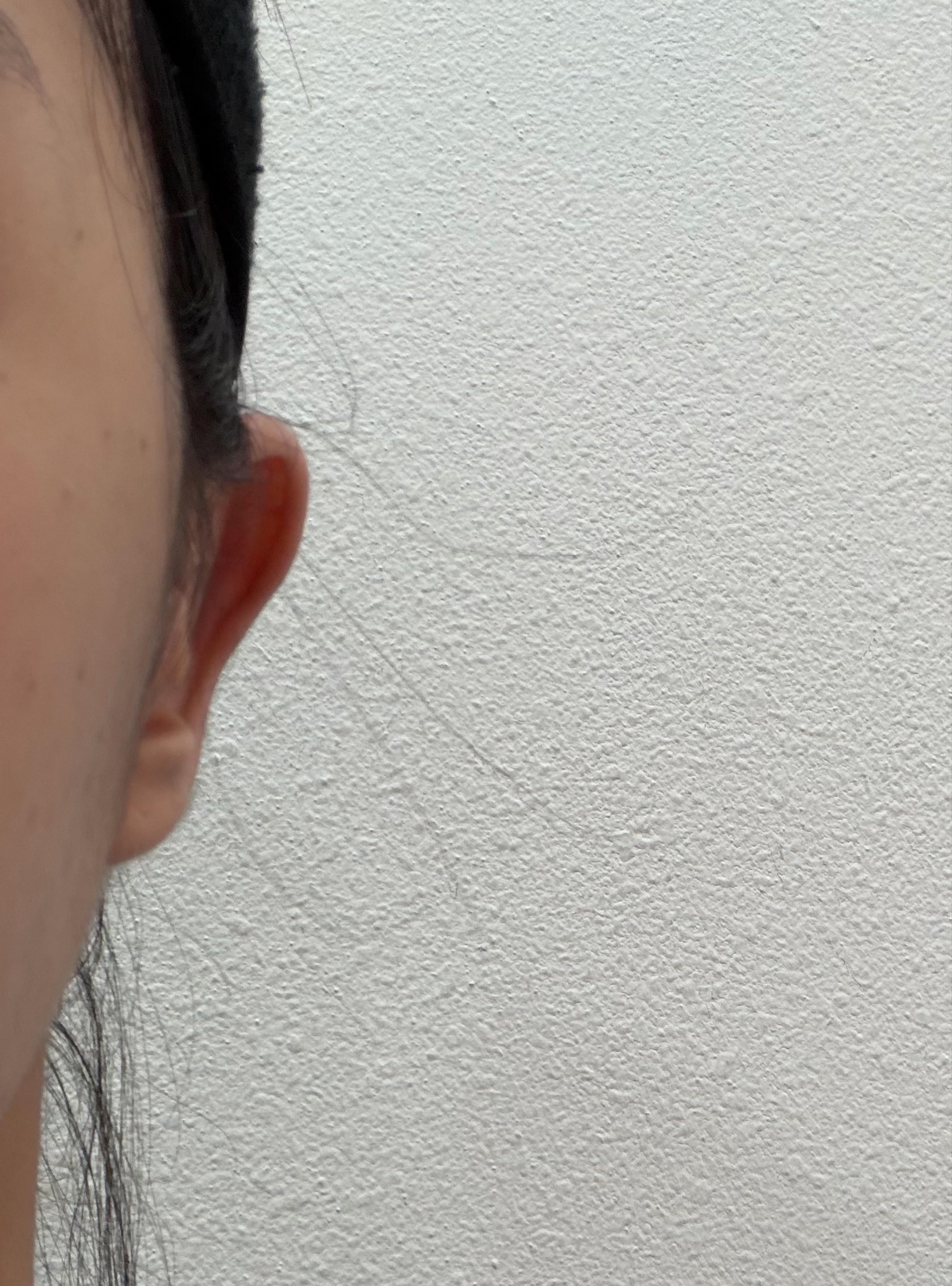 後