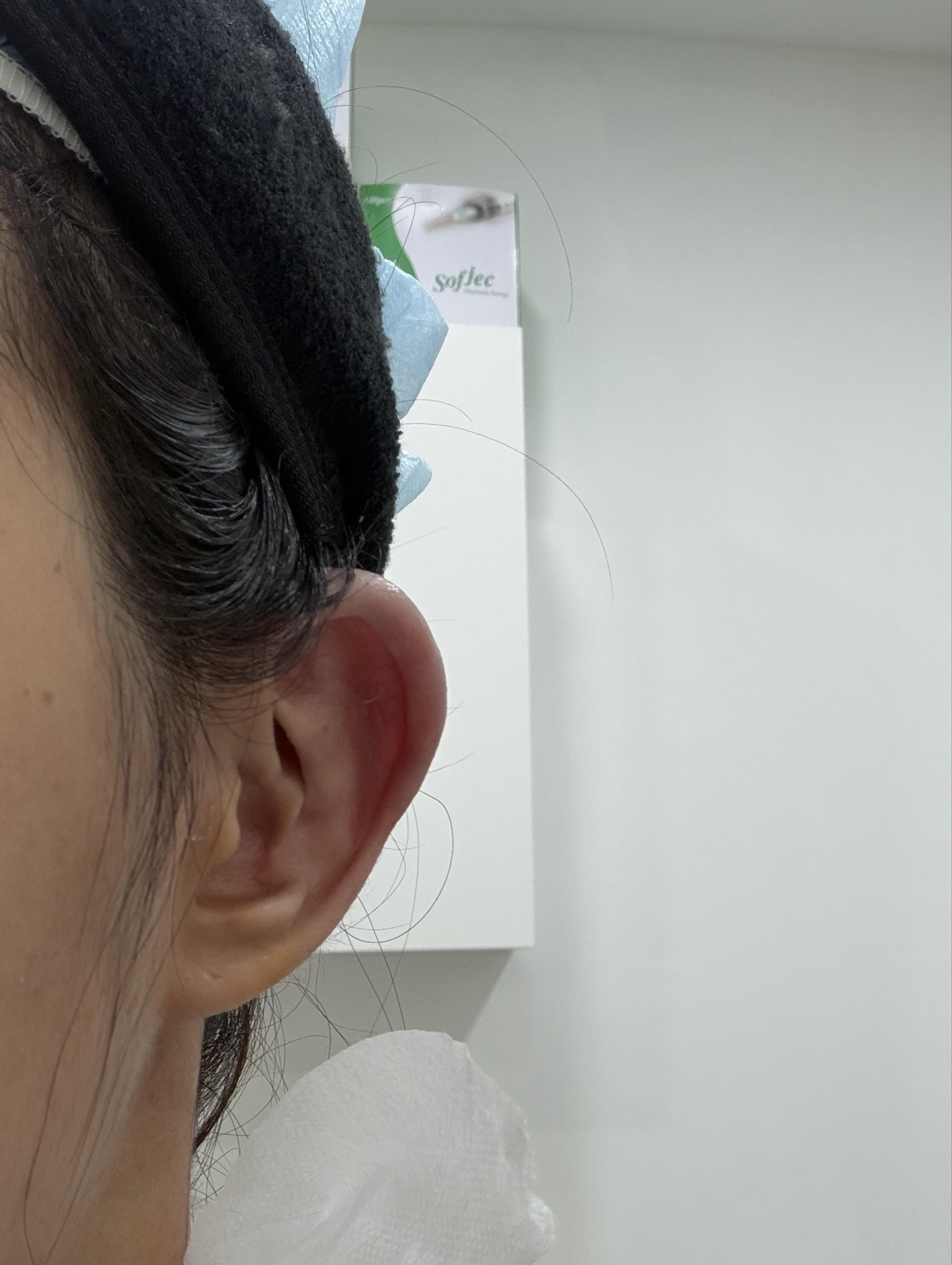 後