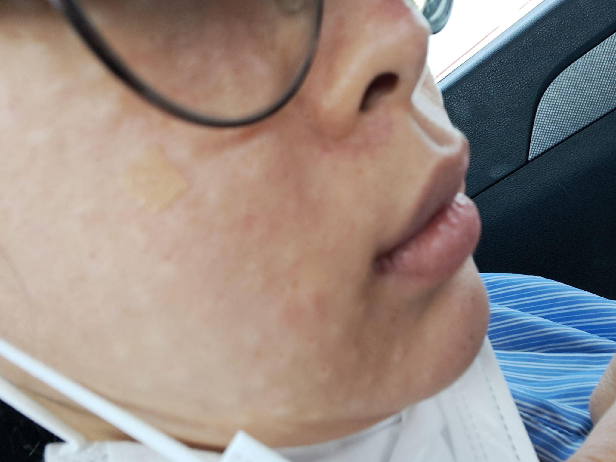 後
