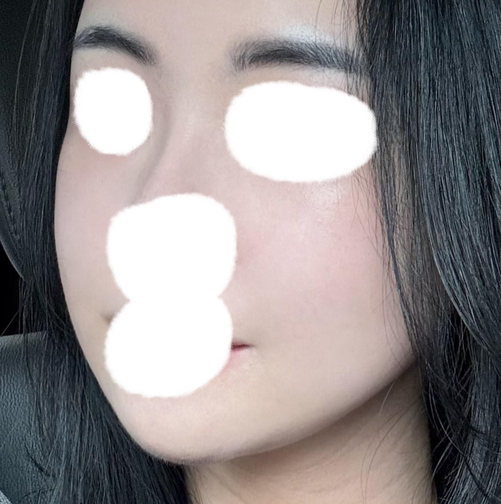 後