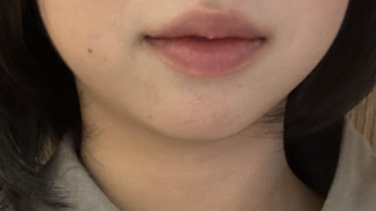 後