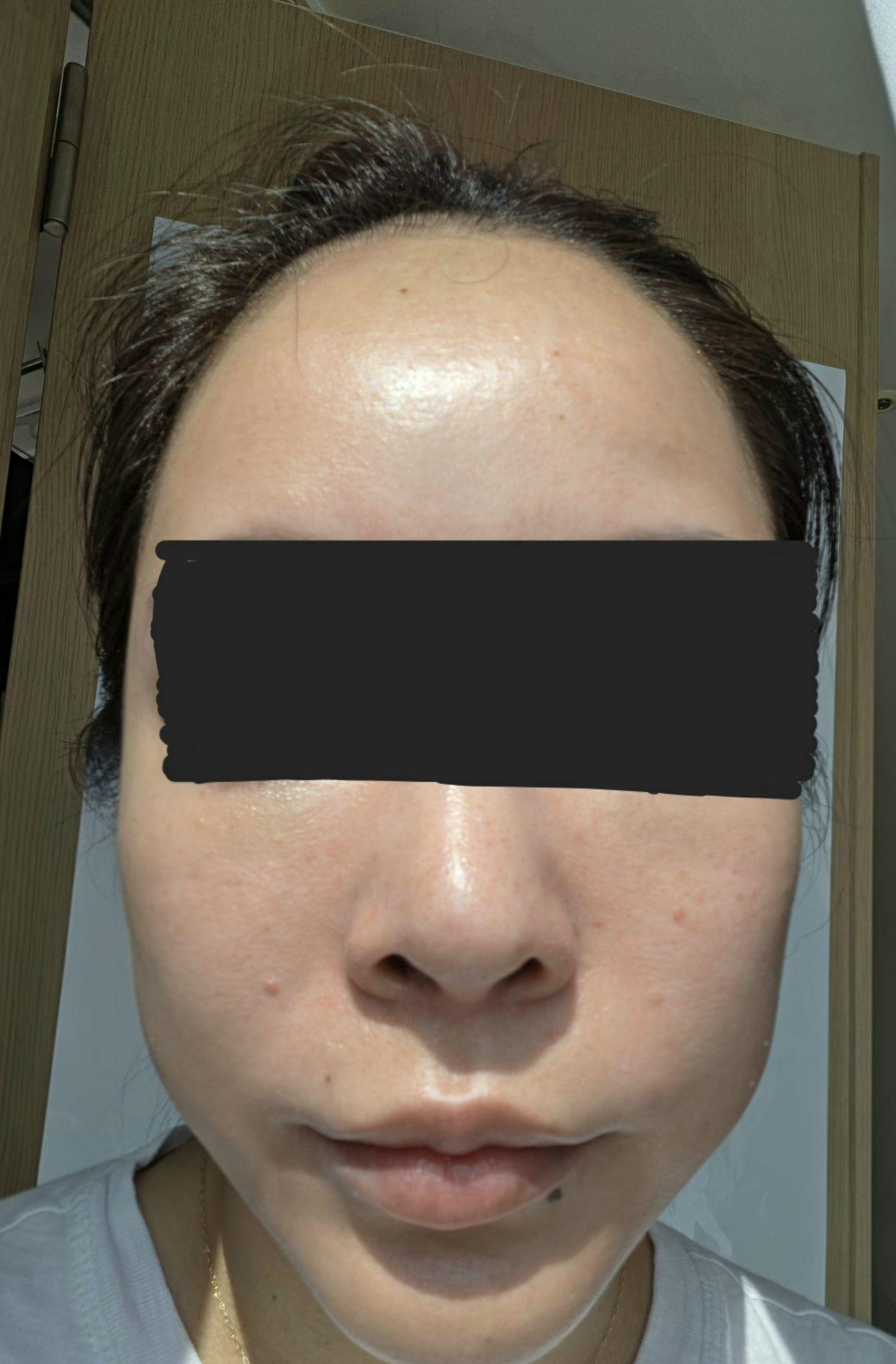 After