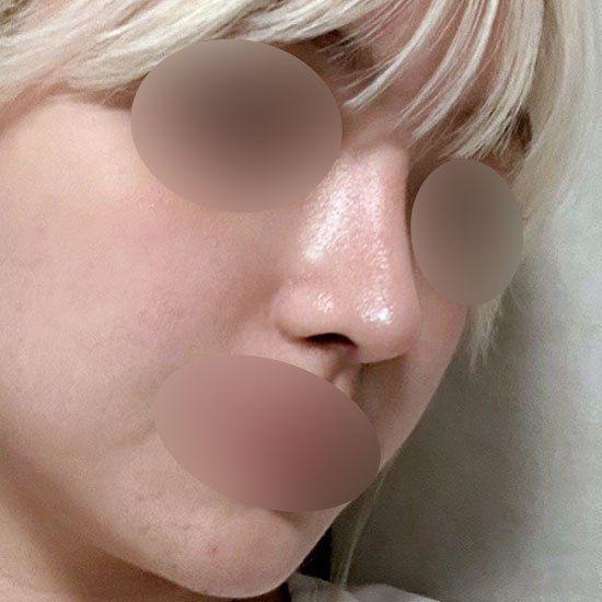 後