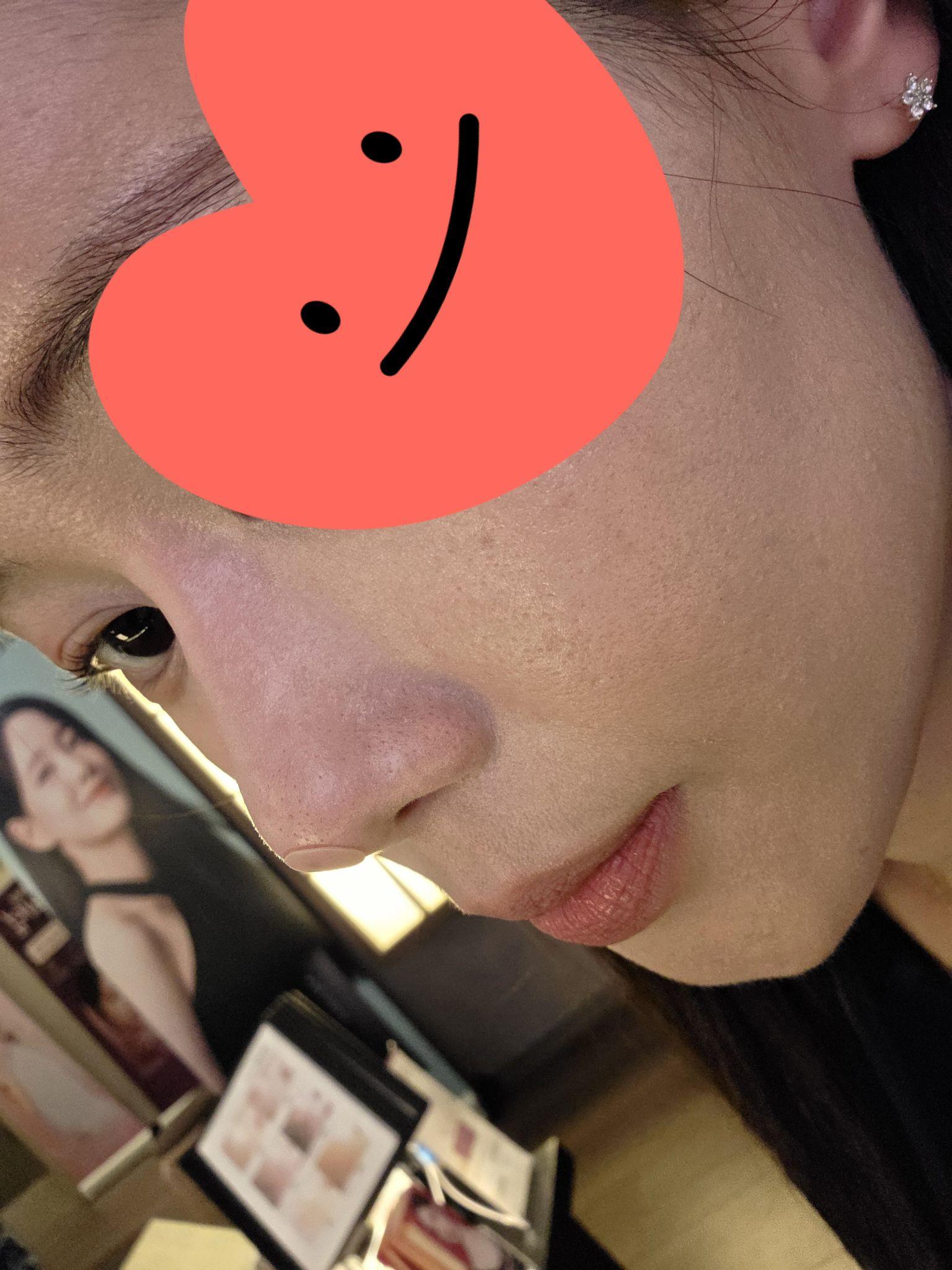 前