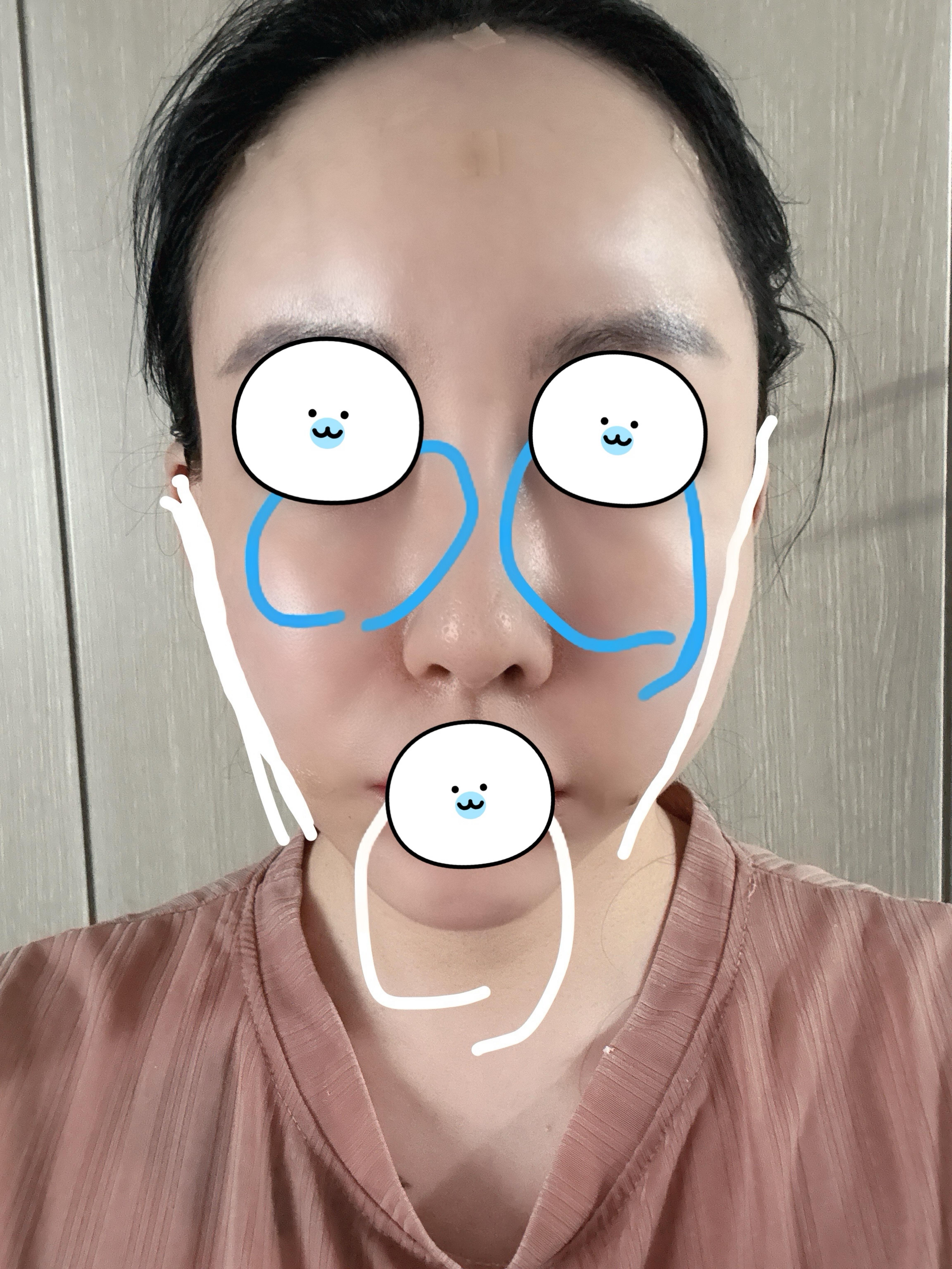 後