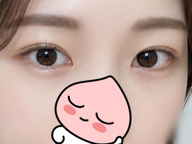 后