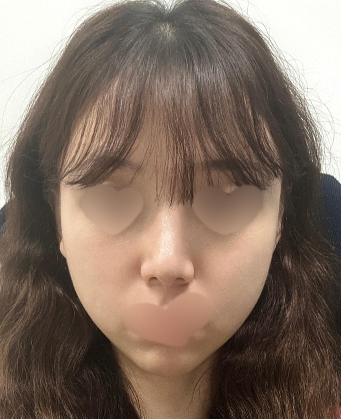 後