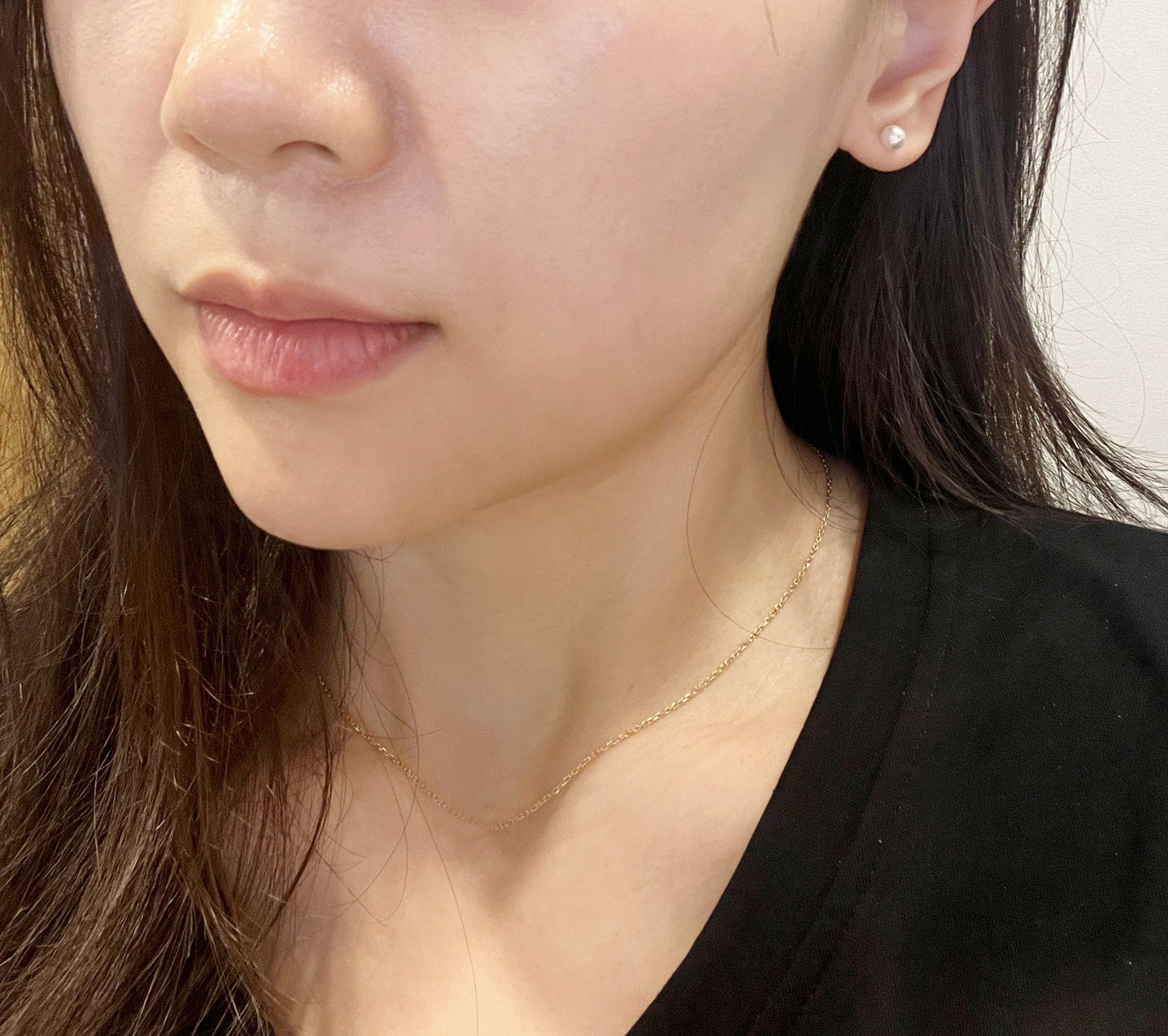 後