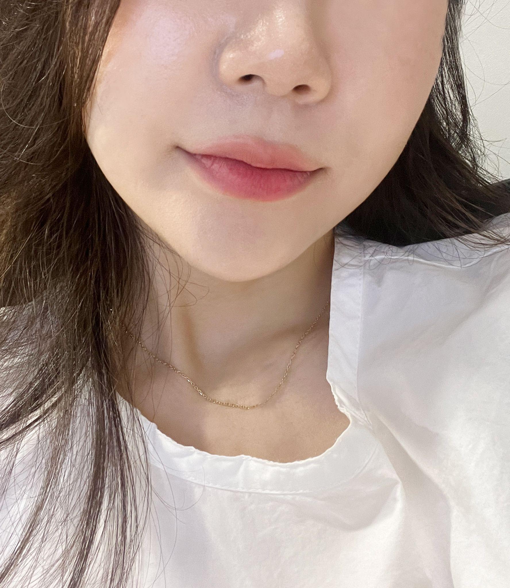 後