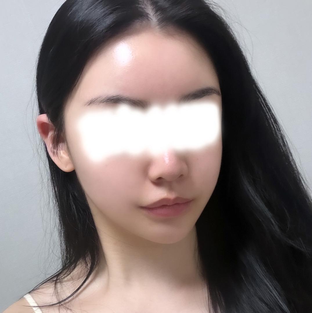後