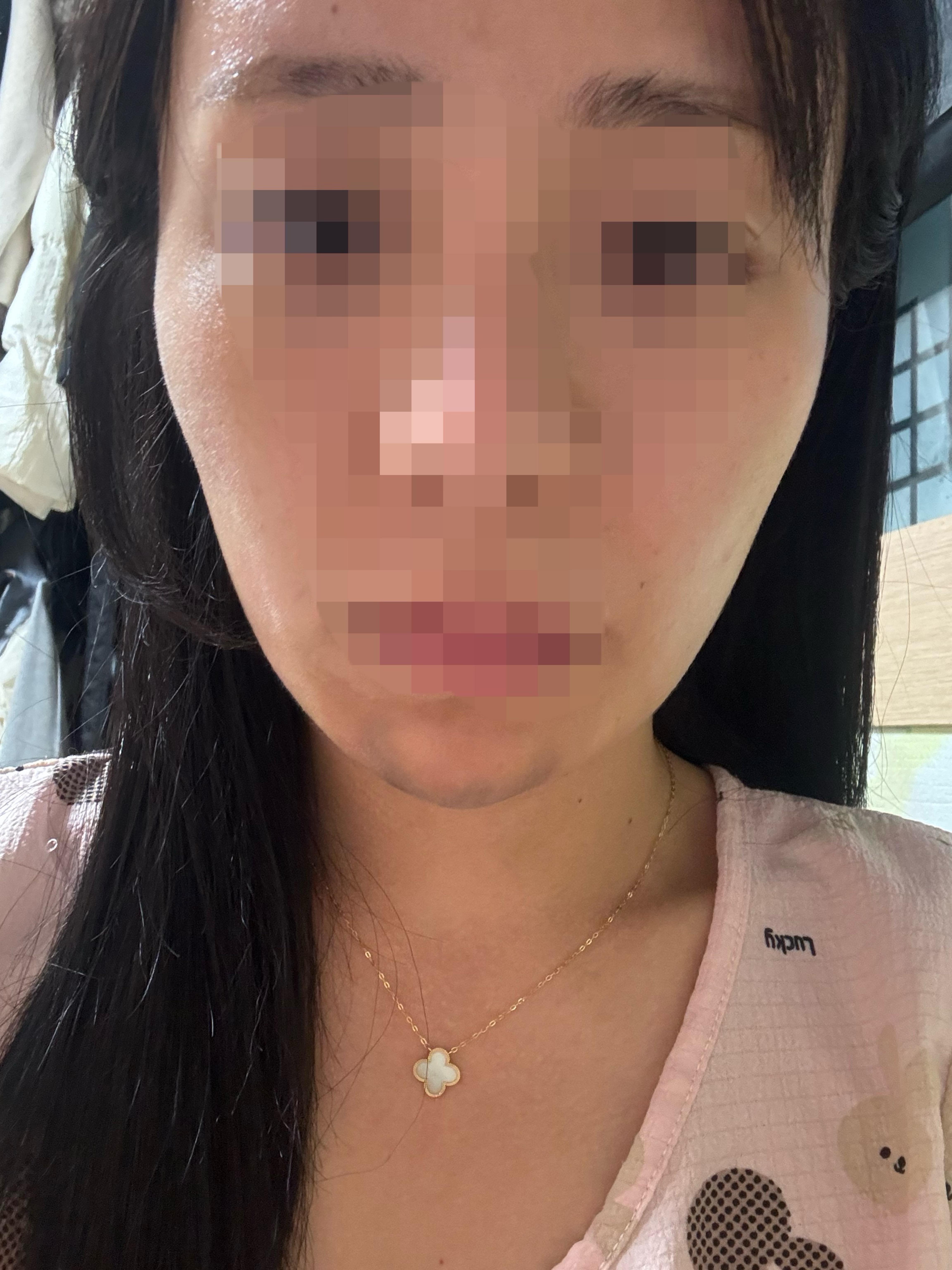 後