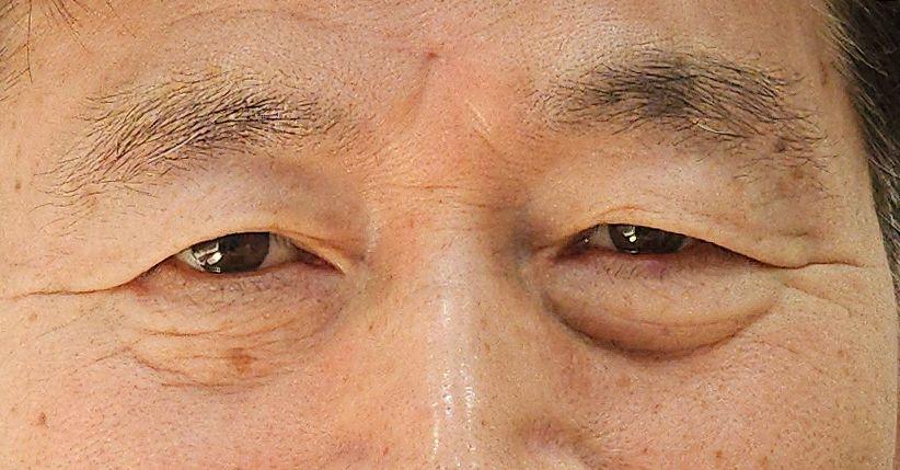 後