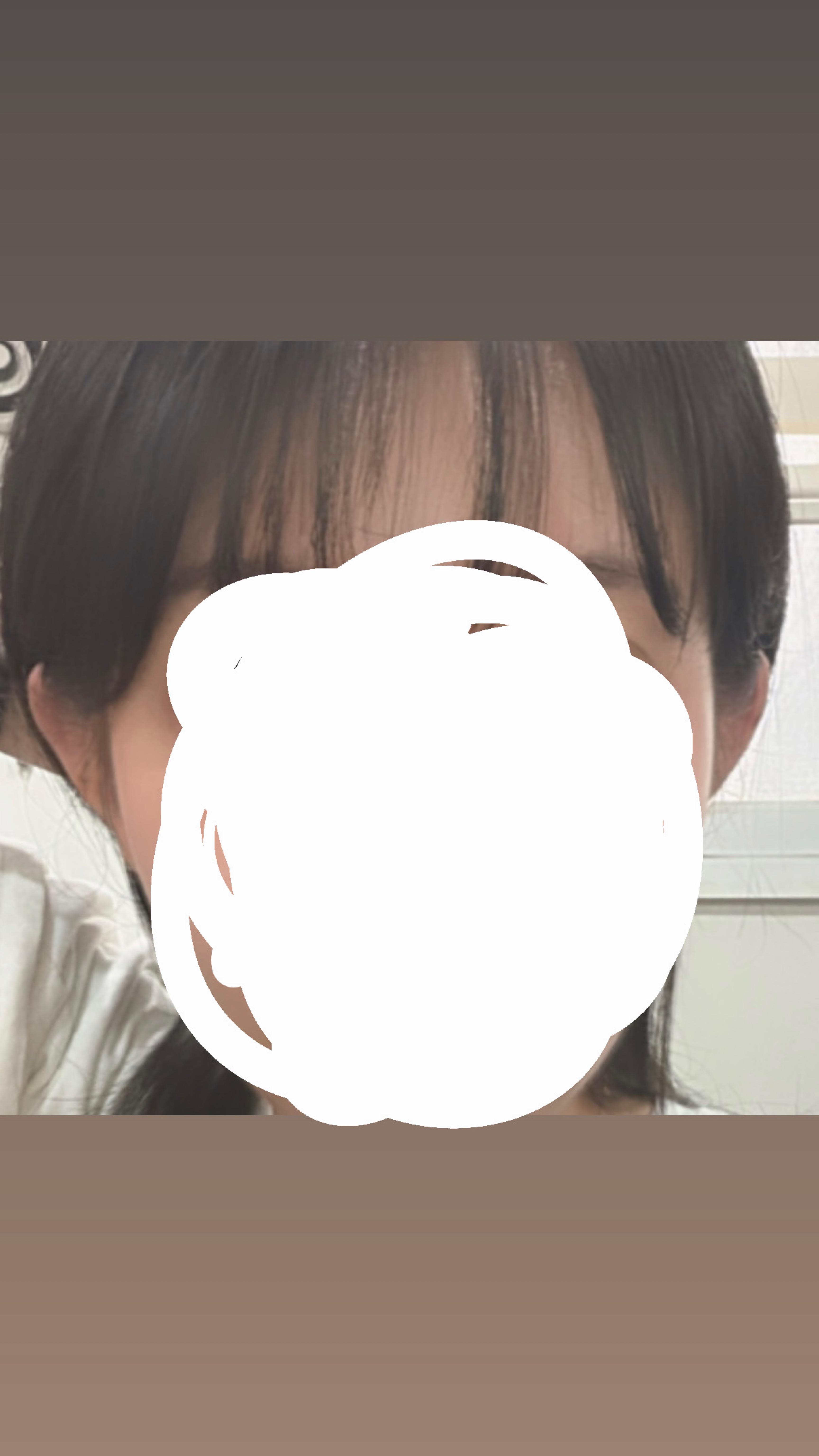 後