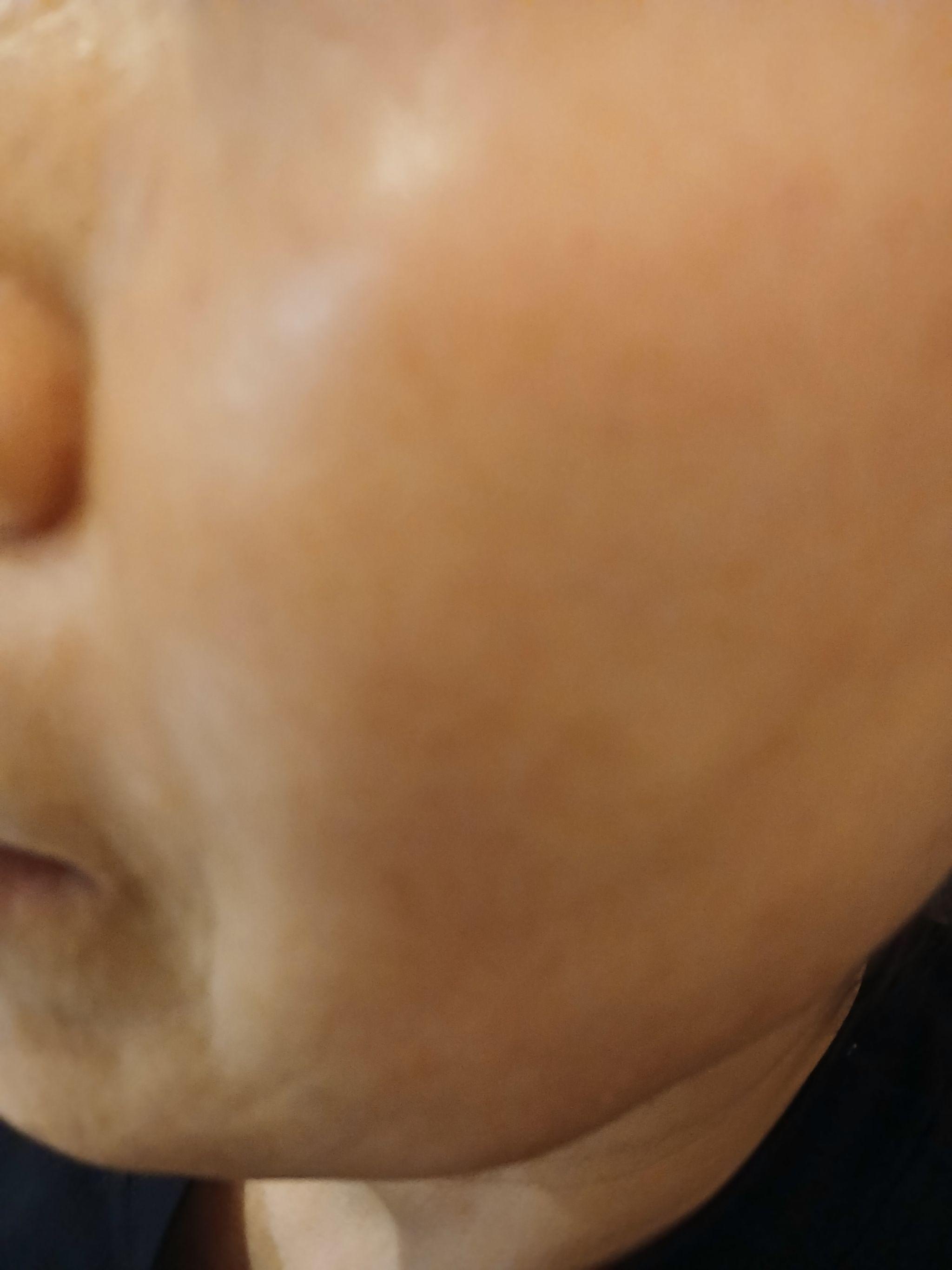 後