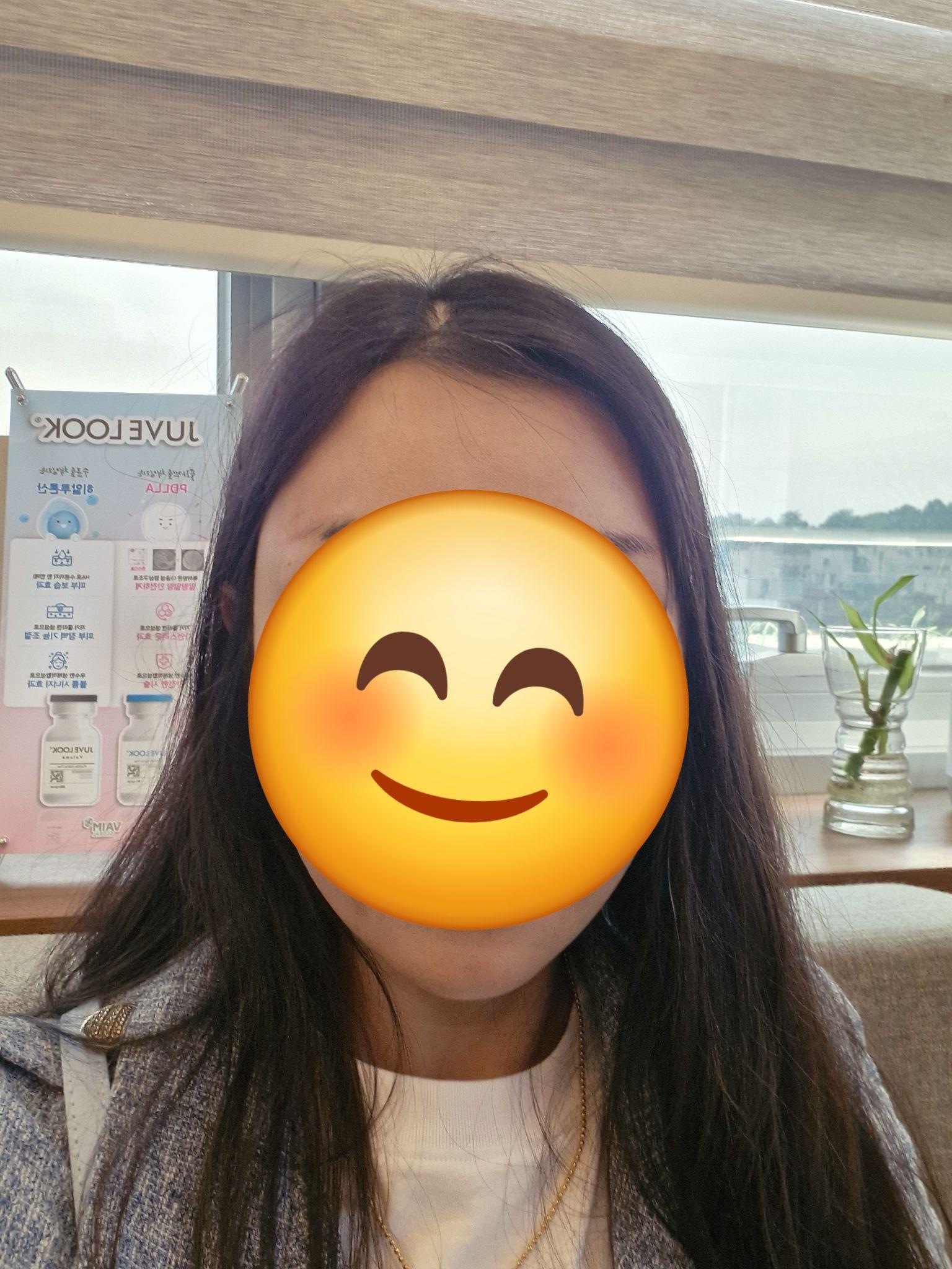 前