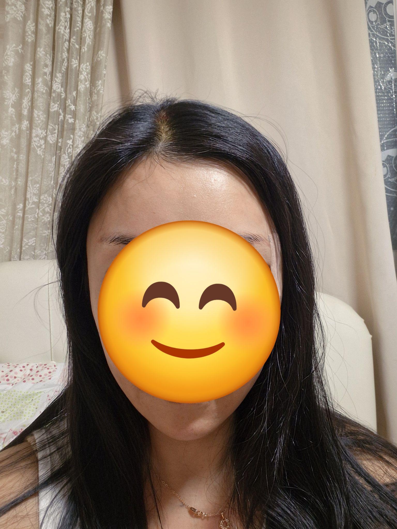 后