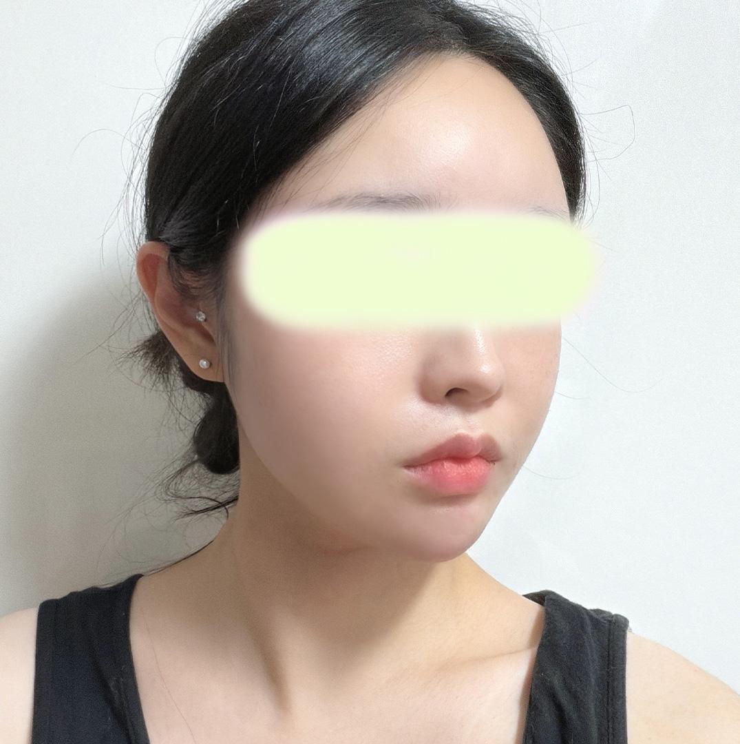 後