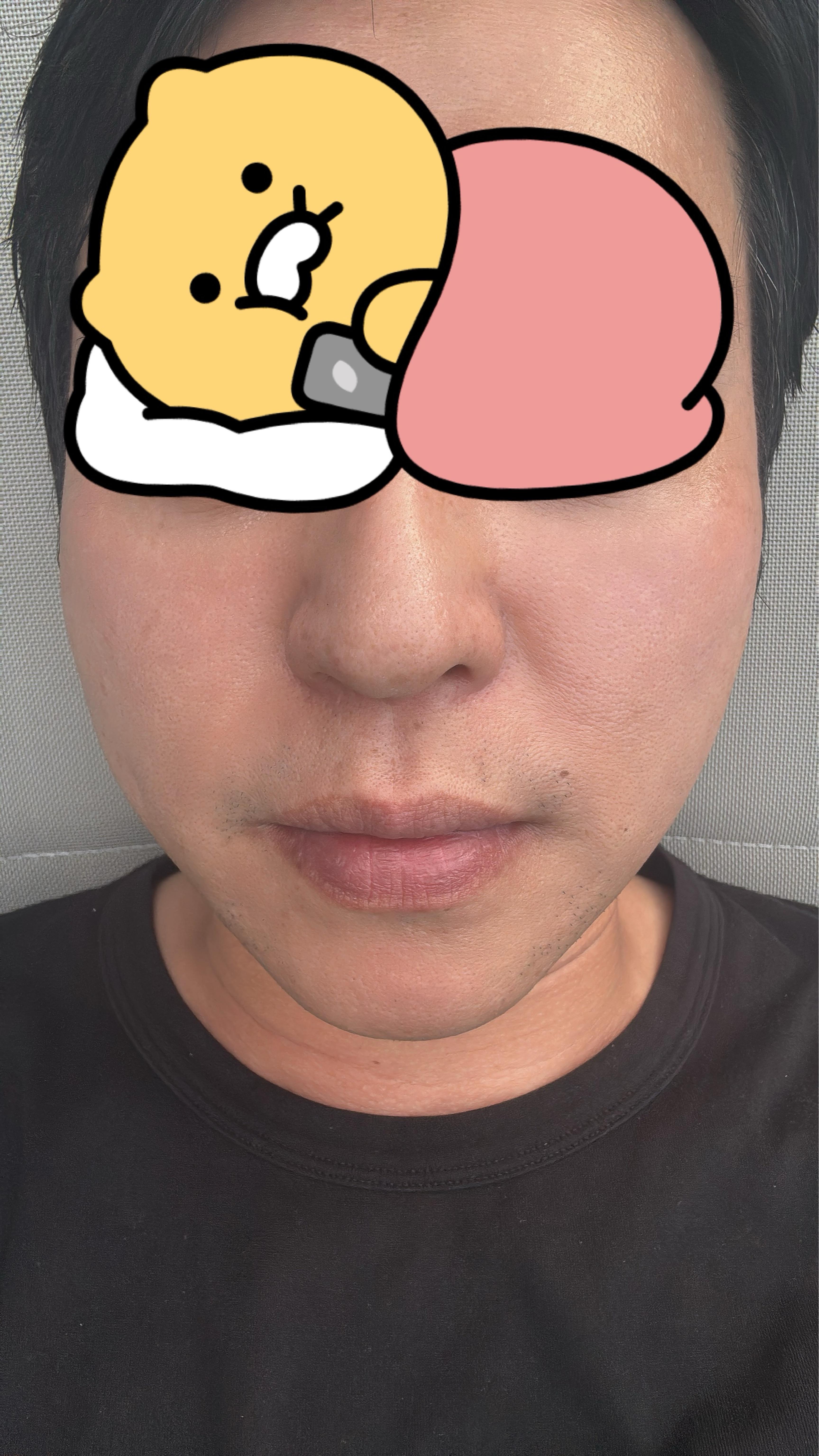 後