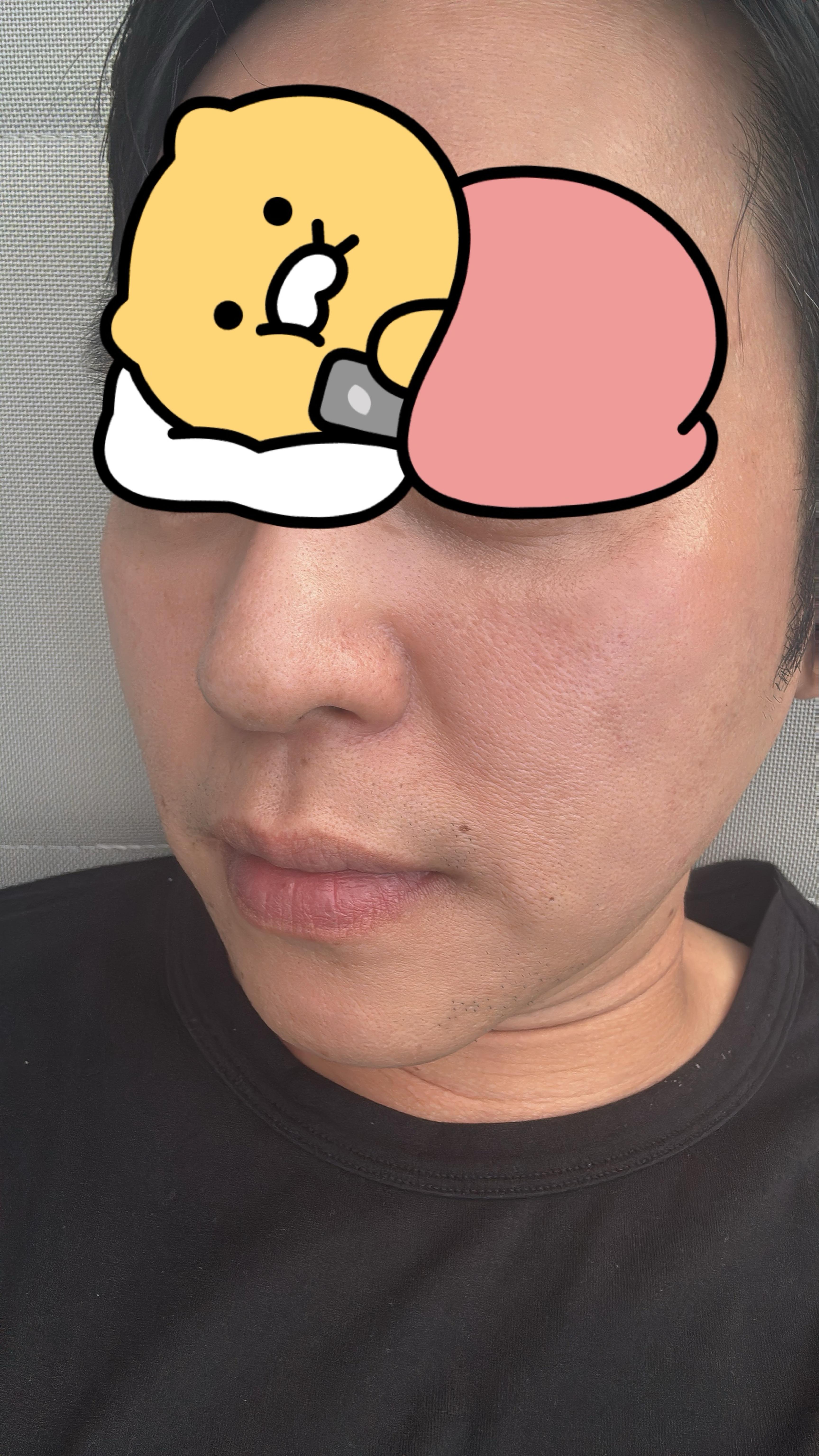 後