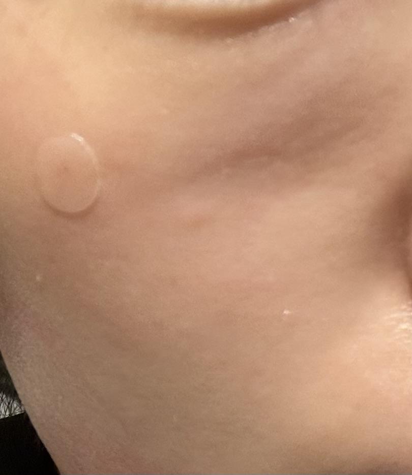 后