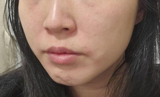 Before