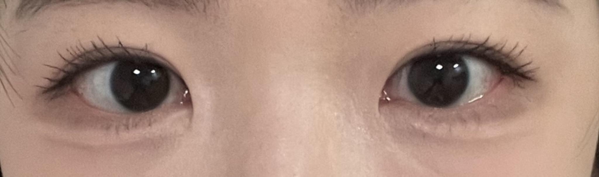 後