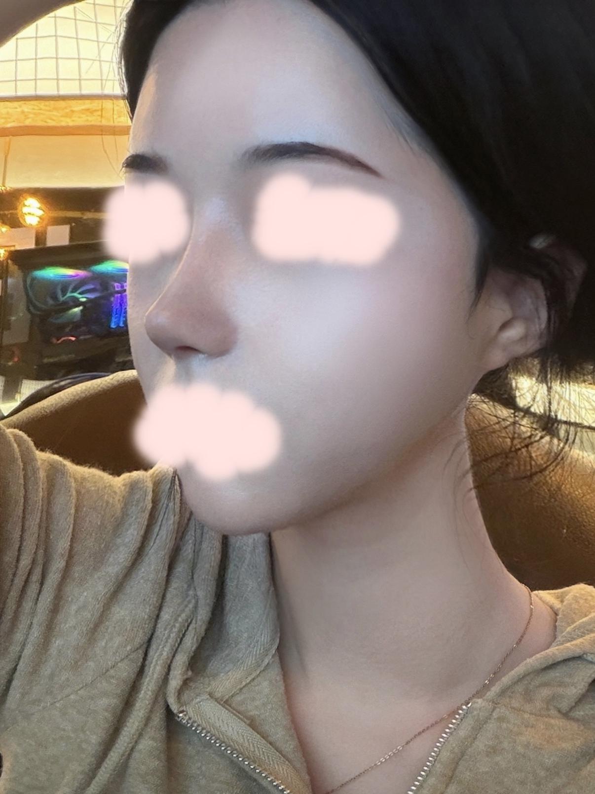 後