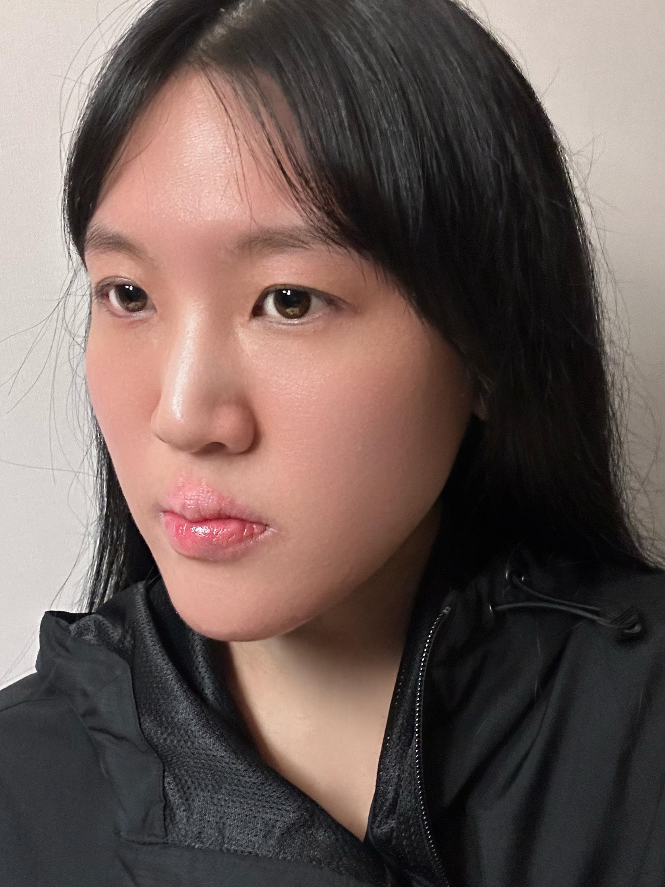 後