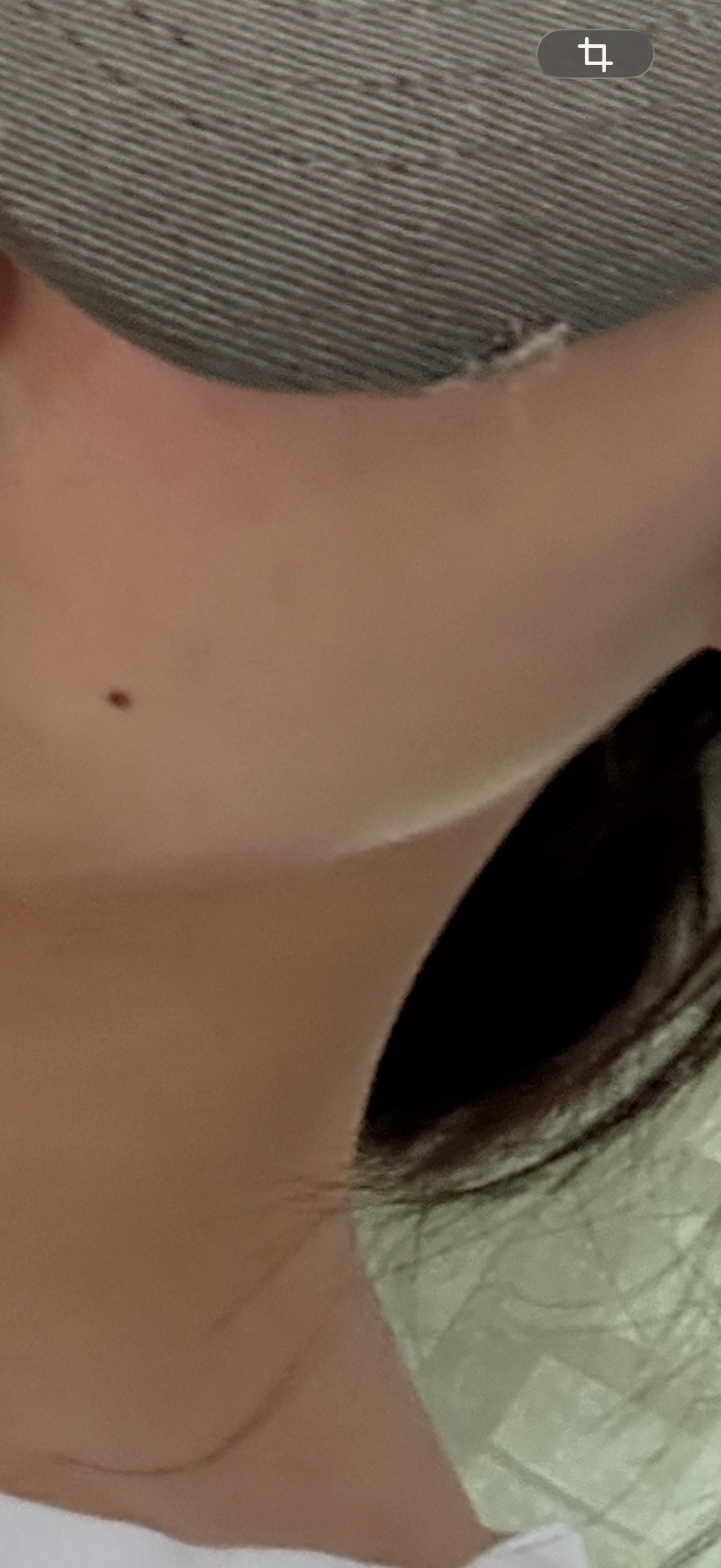 後