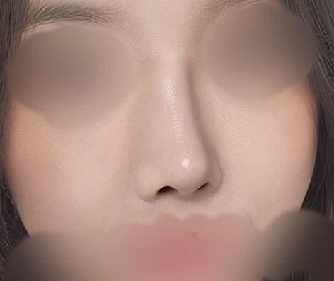 后