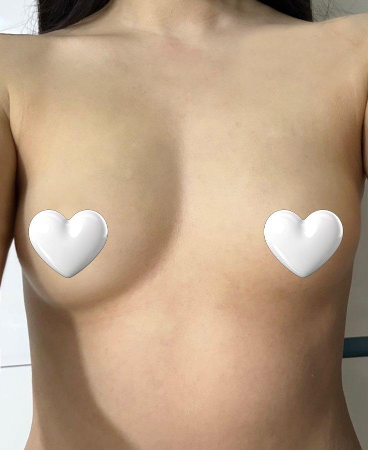 後