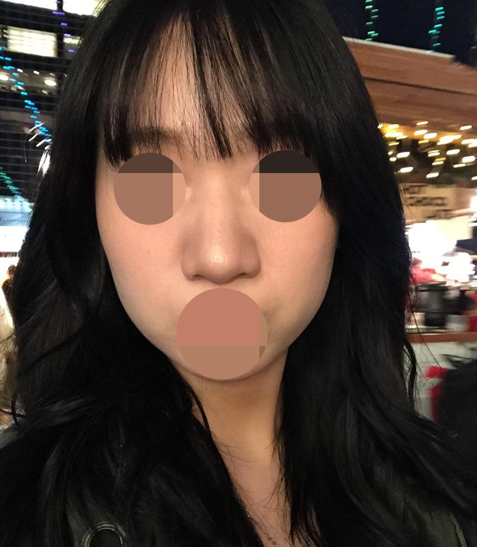 後