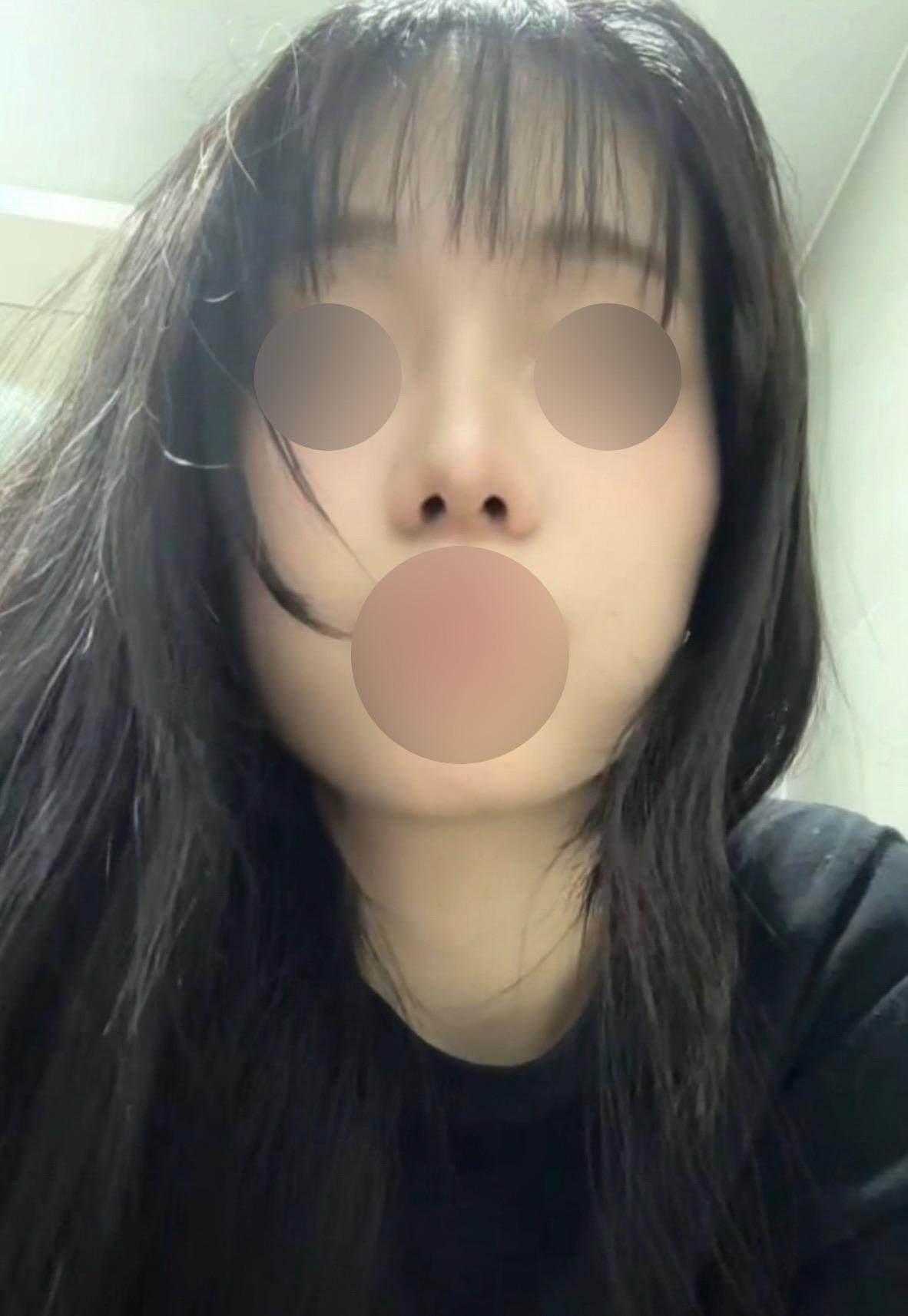 後