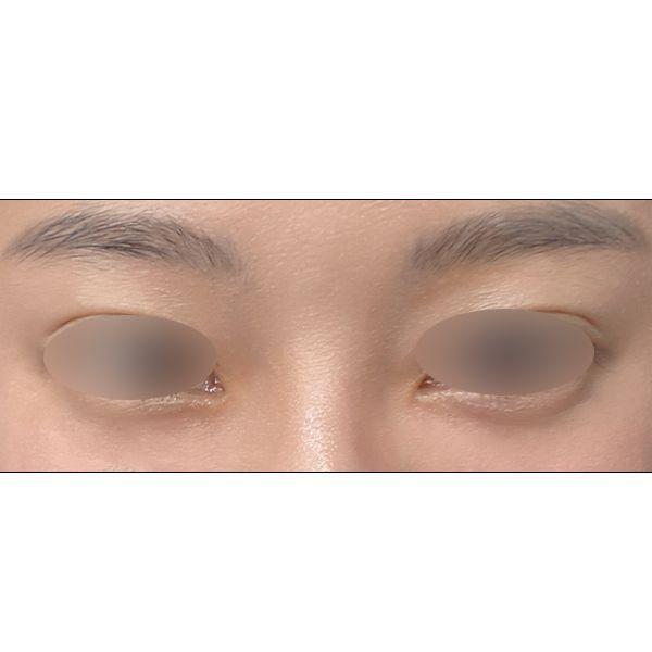 后
