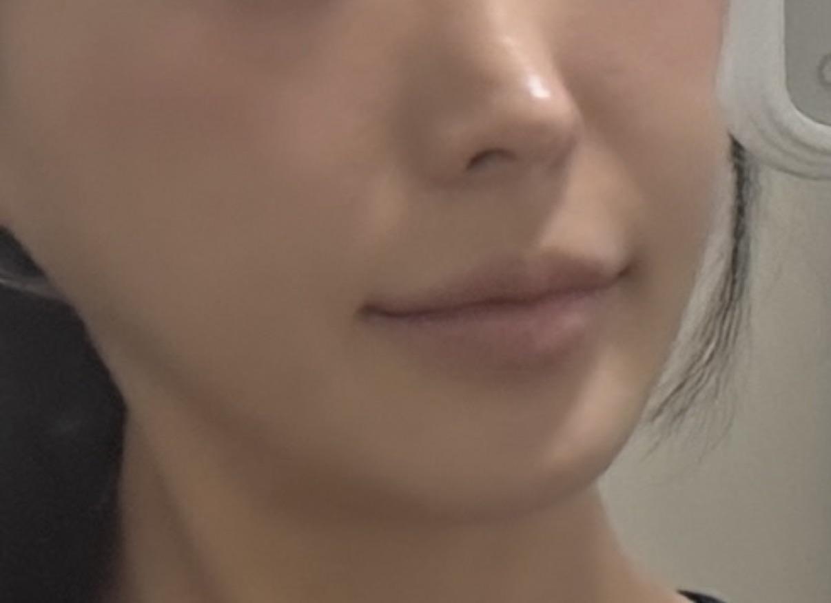 後