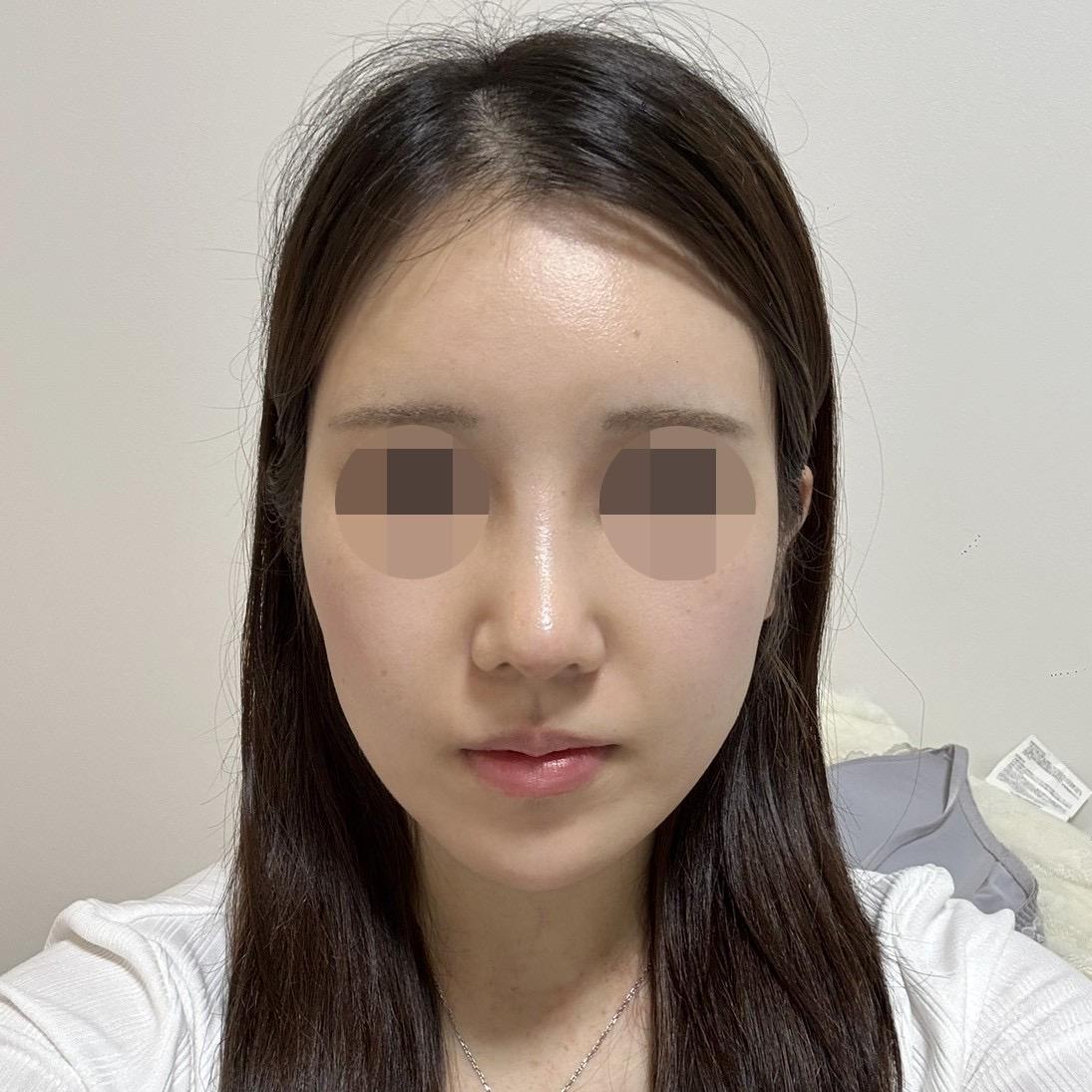 後