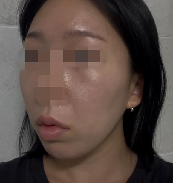 後