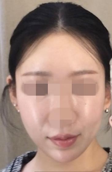 後