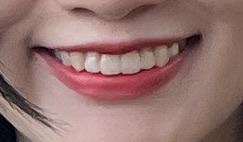 後