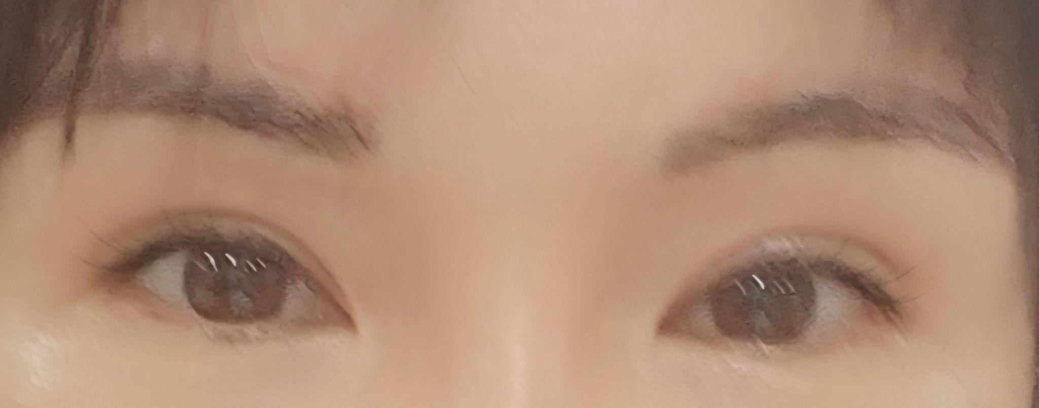前