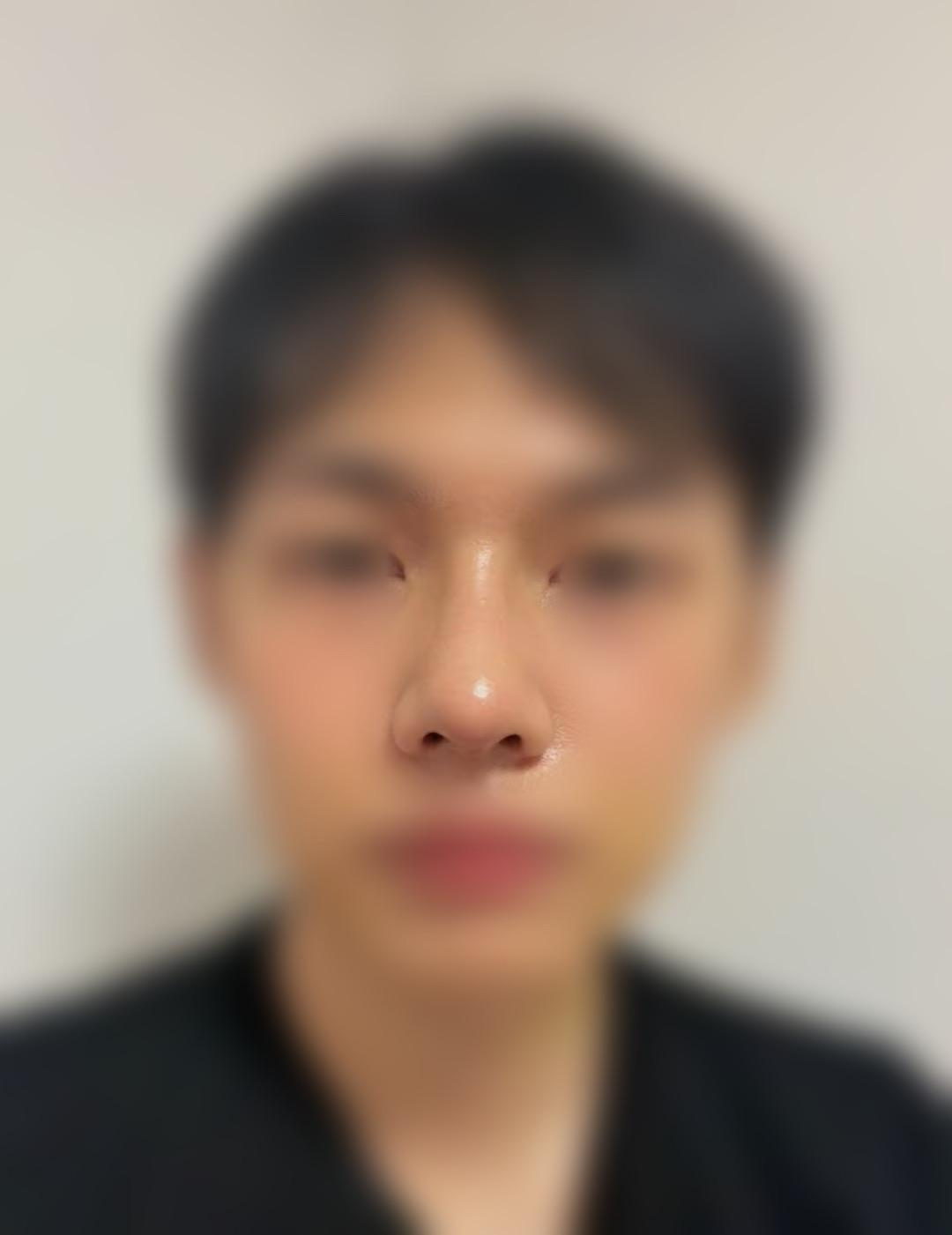 後