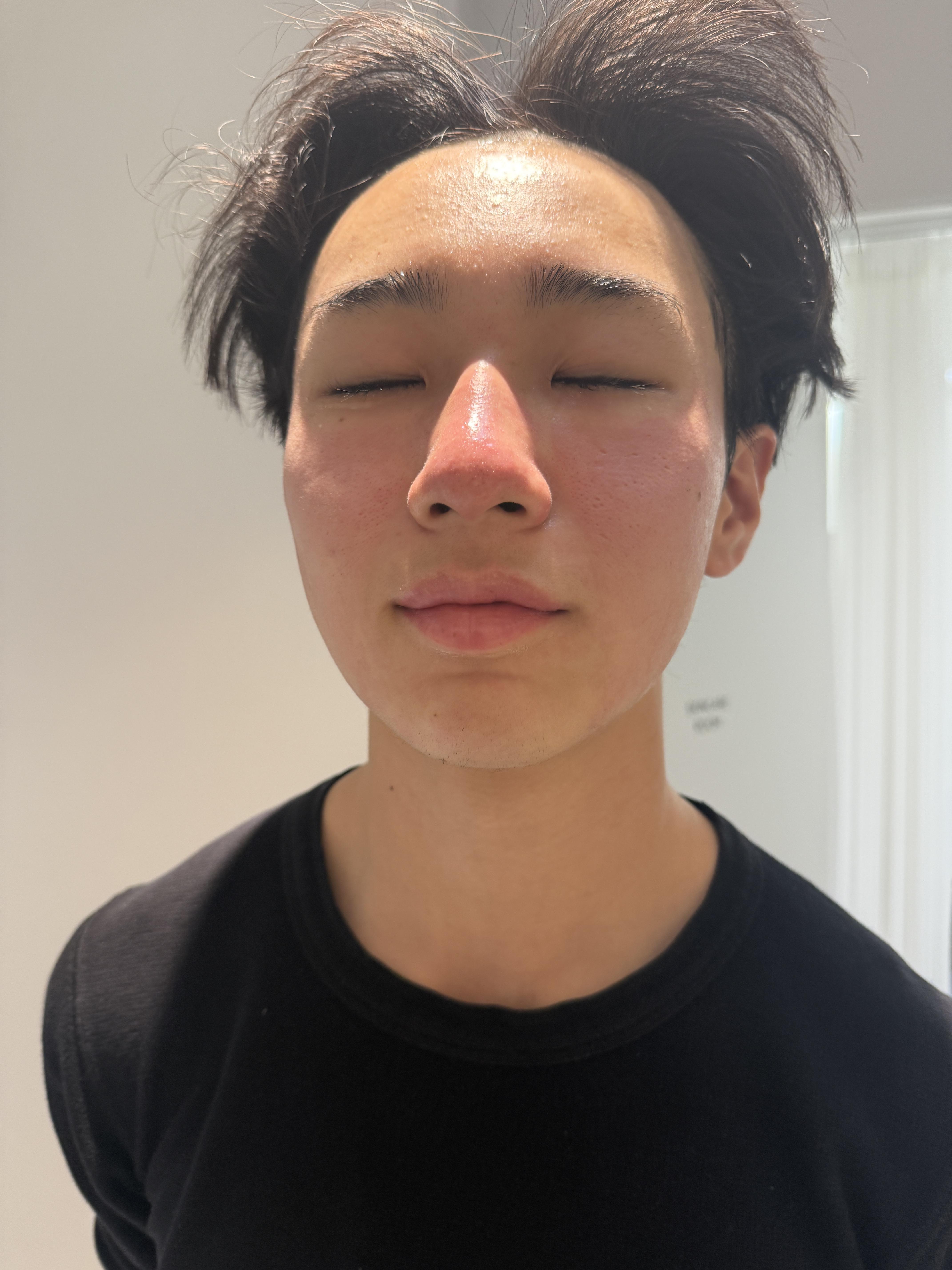 前